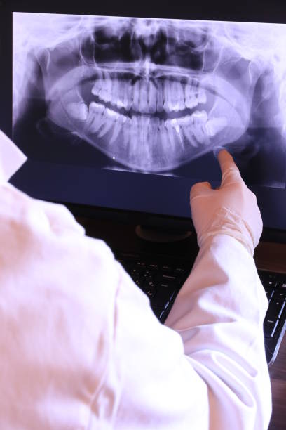 Best Chipped Tooth Repair Near Me  in Marshville, NC