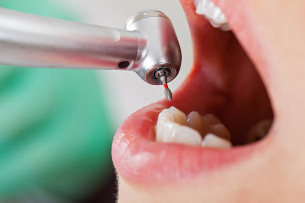 Best Urgent Tooth Repair  in Marshville, NC